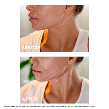V-Facial Intensive Wrap Depuffing Face Mask