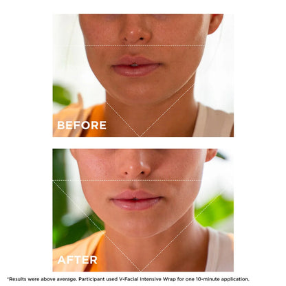 V-Facial Intensive Wrap Depuffing Face Mask